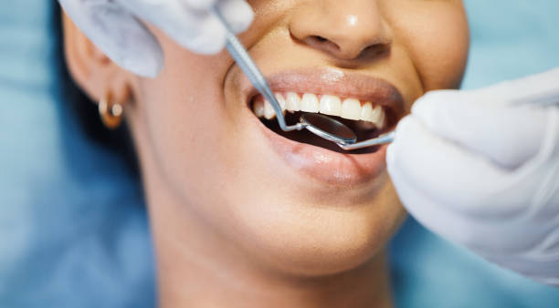 Best Emergency Dentist for Knocked-Out Tooth in Sergeant Bluff, IA